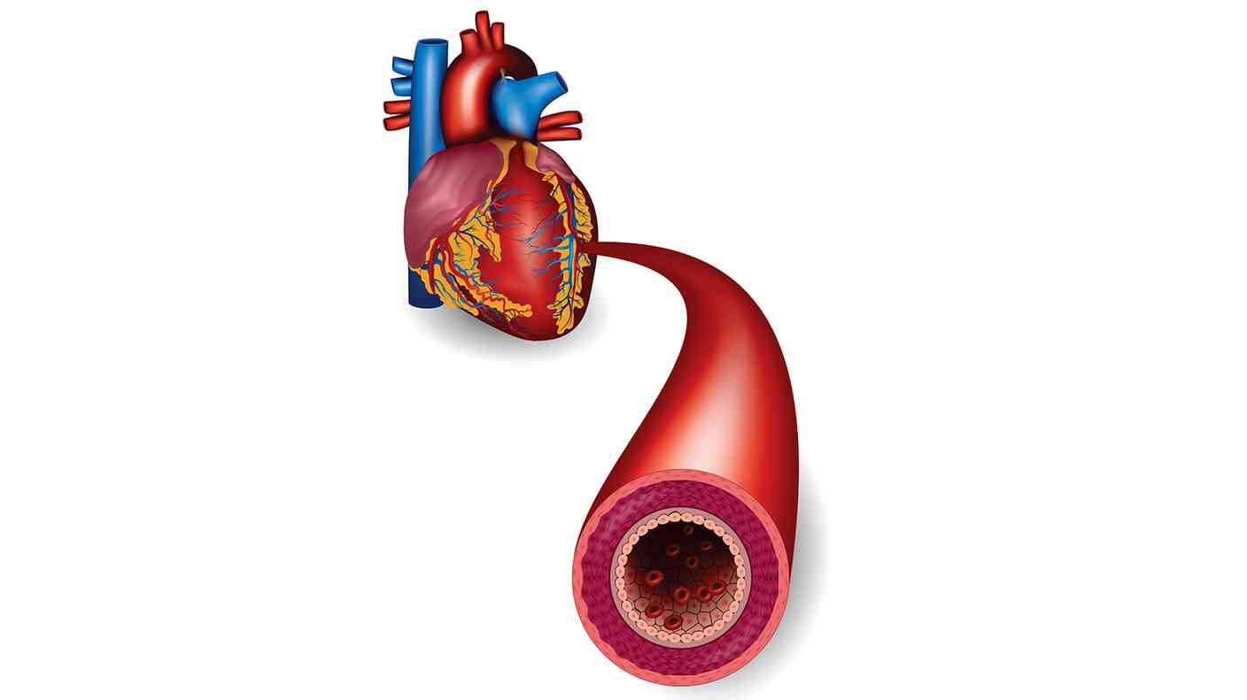 تطوير أداة لإصلاح صمامات القلب التالفة P_174316cr11
